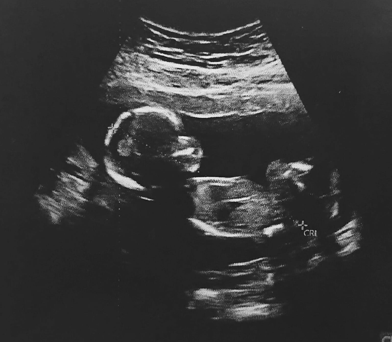 Papitos